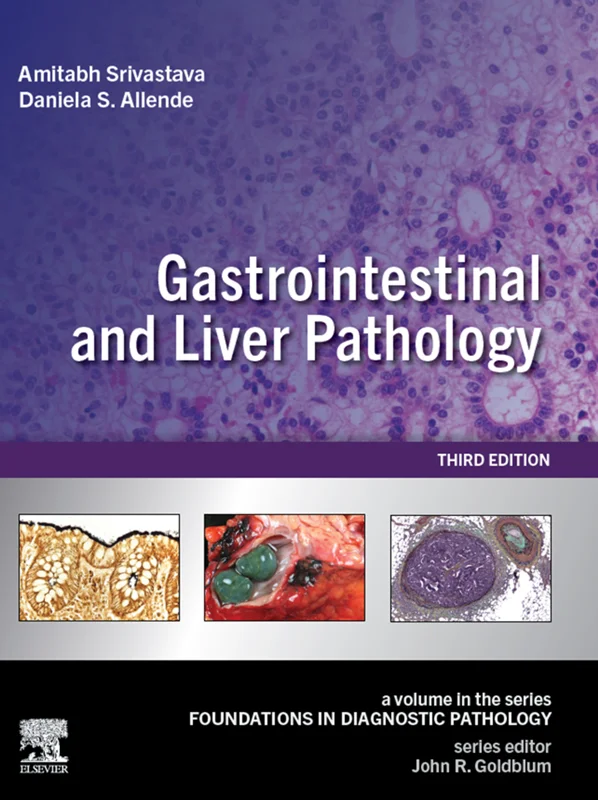 Gastrointestinal and Liver Pathology: A Volume in the Series: Foundations in Diagnostic Pathology 3rd Edition