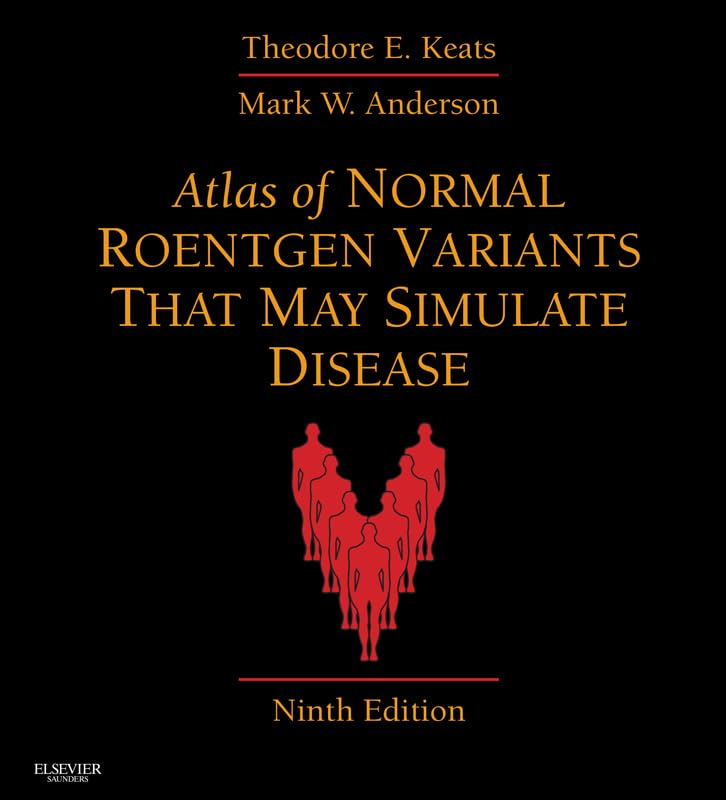 Atlas of Normal Roentgen Variants That May Simulate Disease 9th Edition