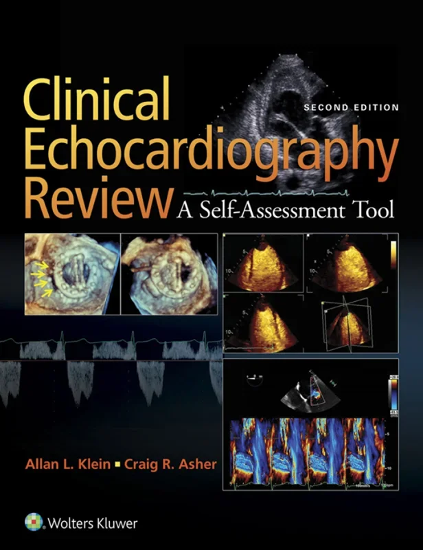Clinical Echocardiography Review 2nd Edition