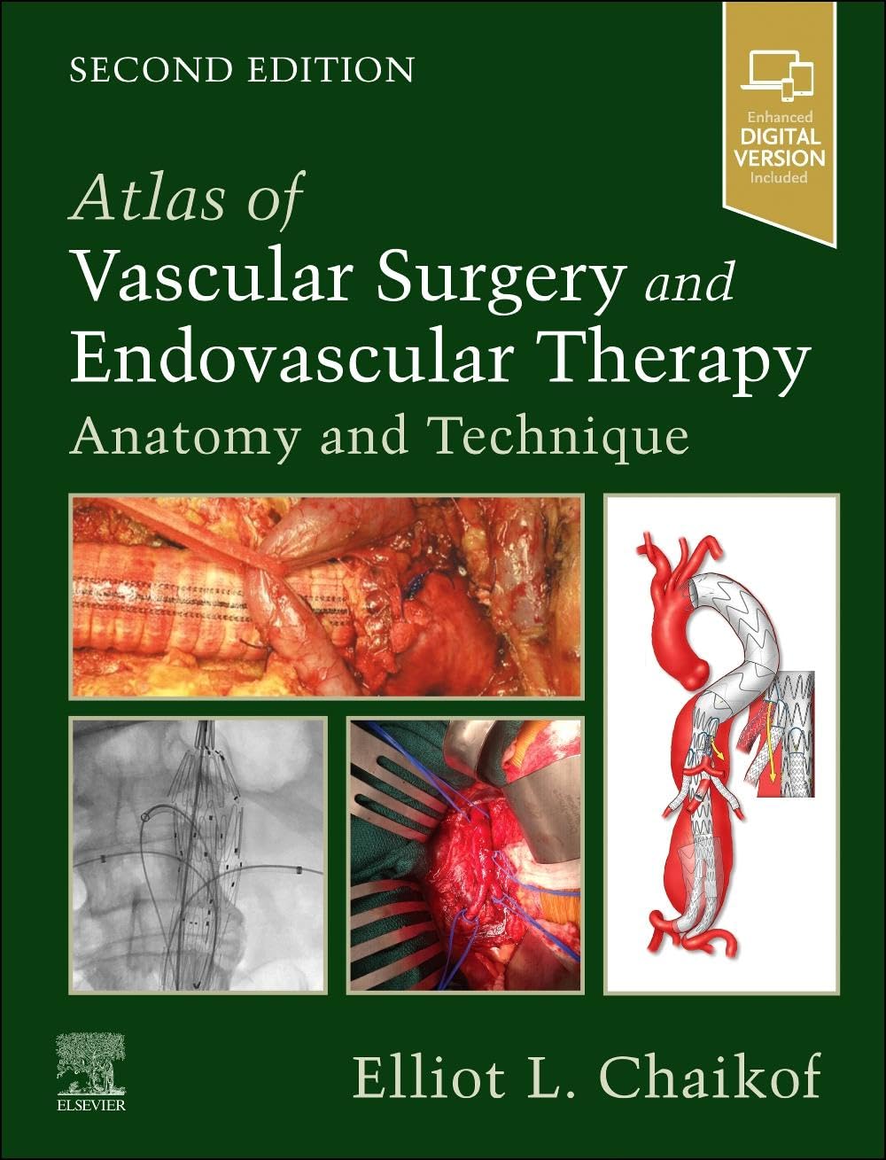 Atlas of Vascular Surgery and Endovascular Therapy: Anatomy and Technique 2nd Edition