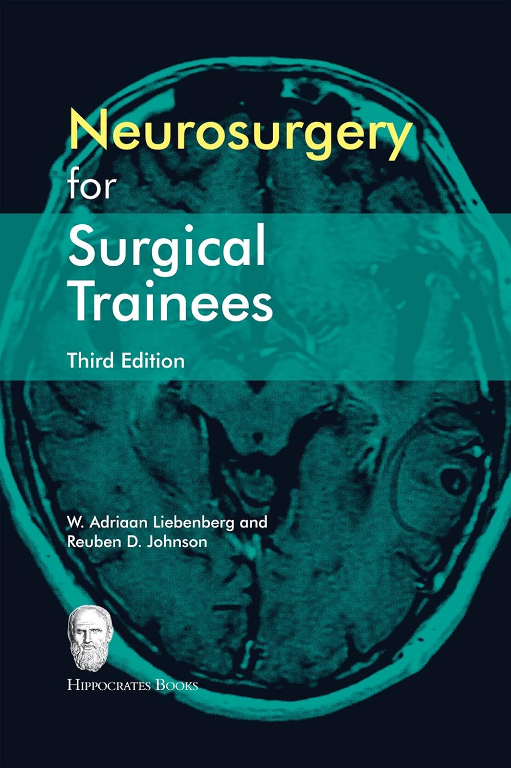 Neurosurgery for Surgical Trainees (Third Edition)